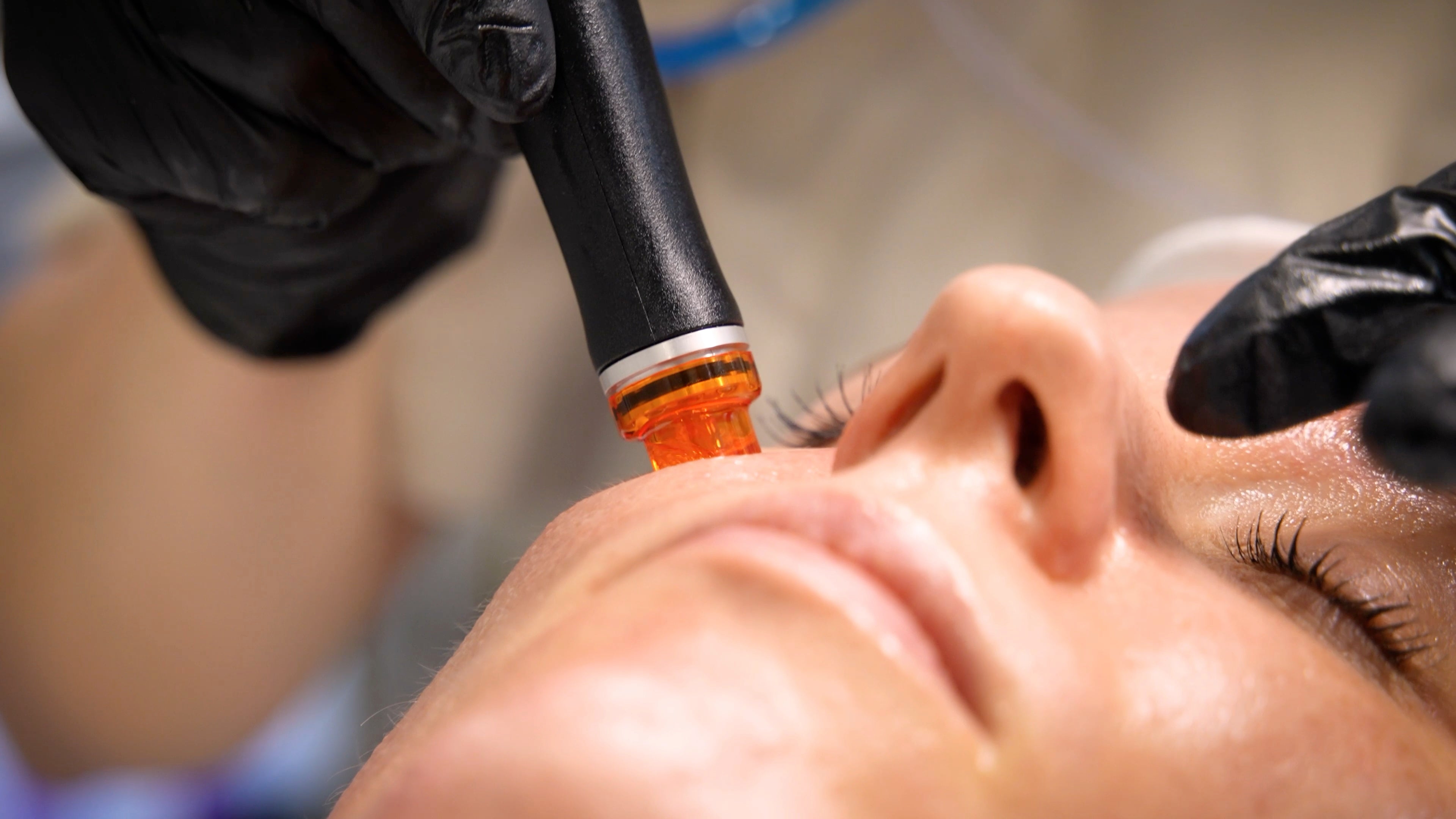 Hydrafacial Behandlungen