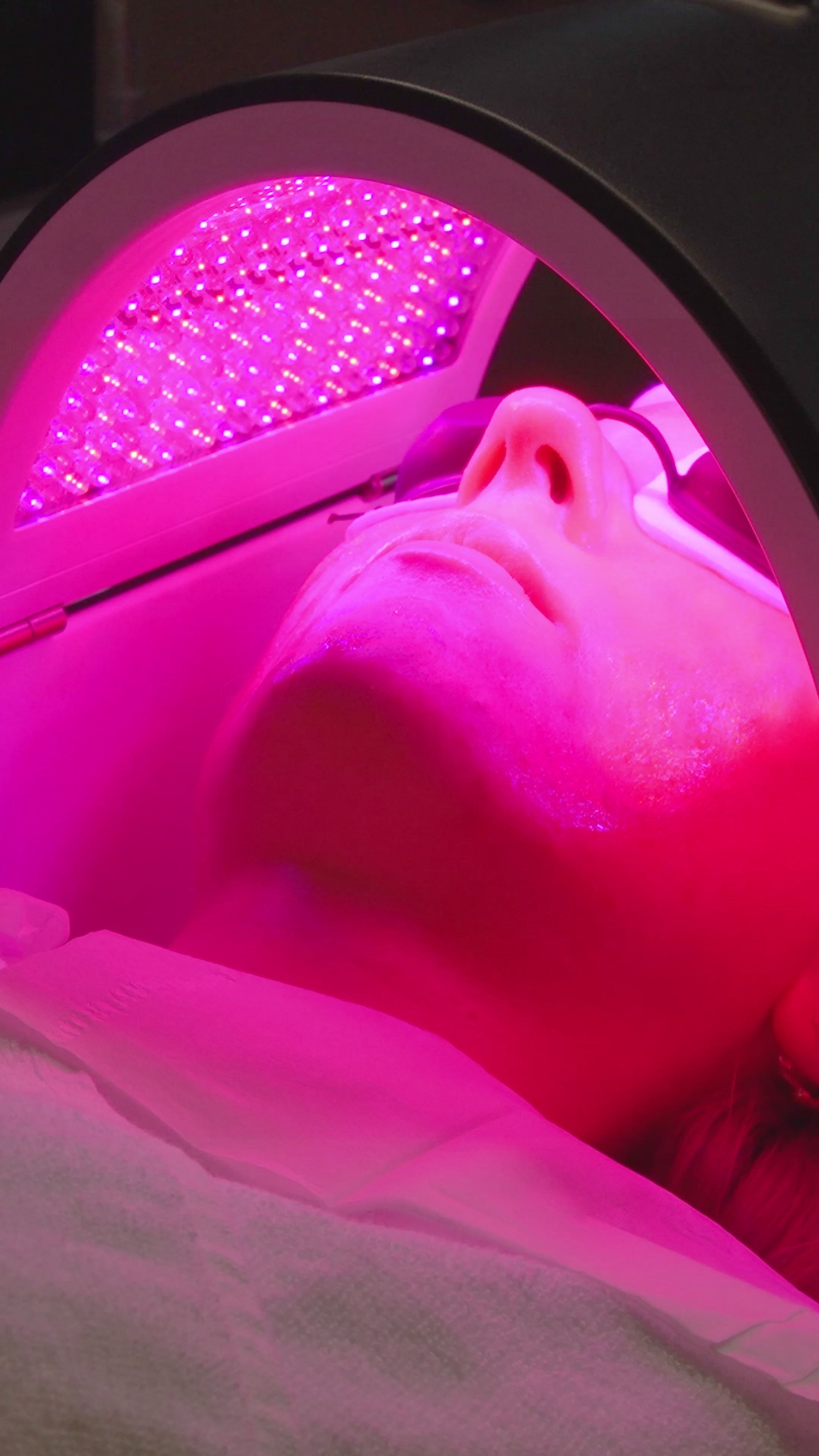 Hydrafacial Treatments