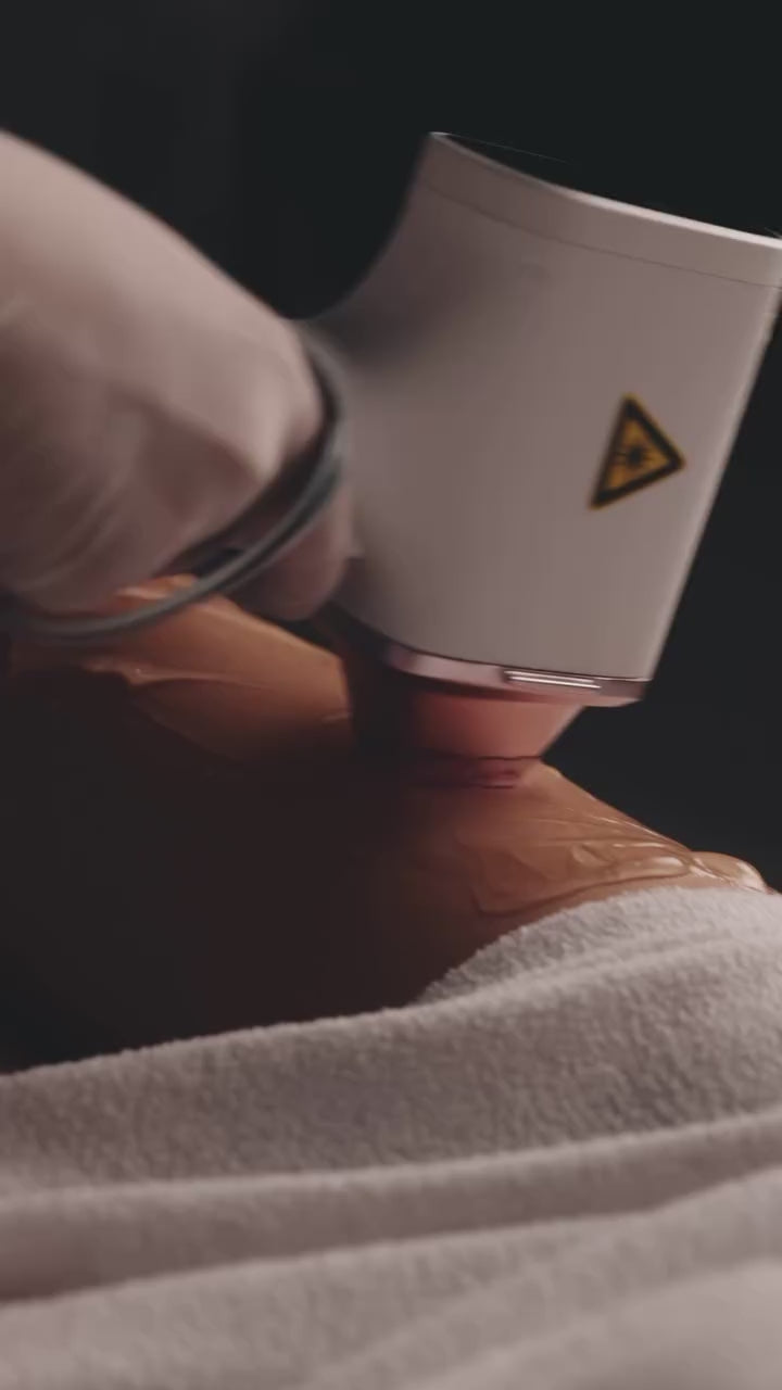 Dauerhafte Laser-Haarentfernung