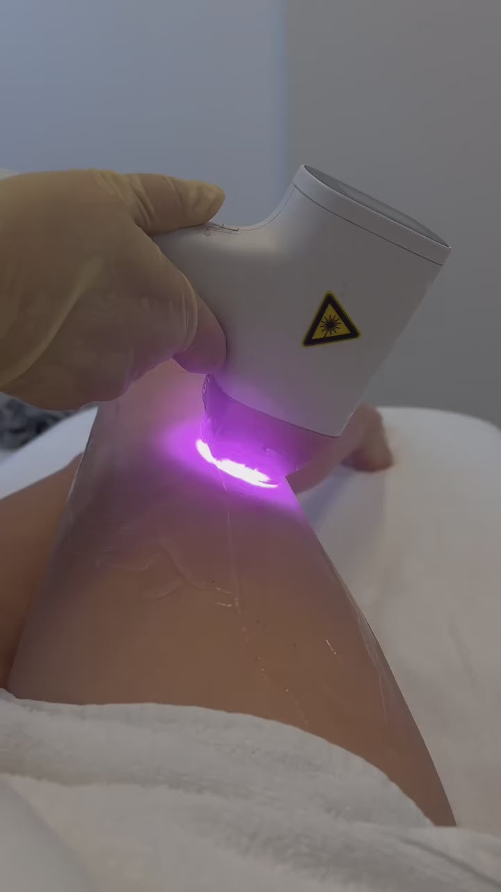 Dauerhafte Laser-Haarentfernung