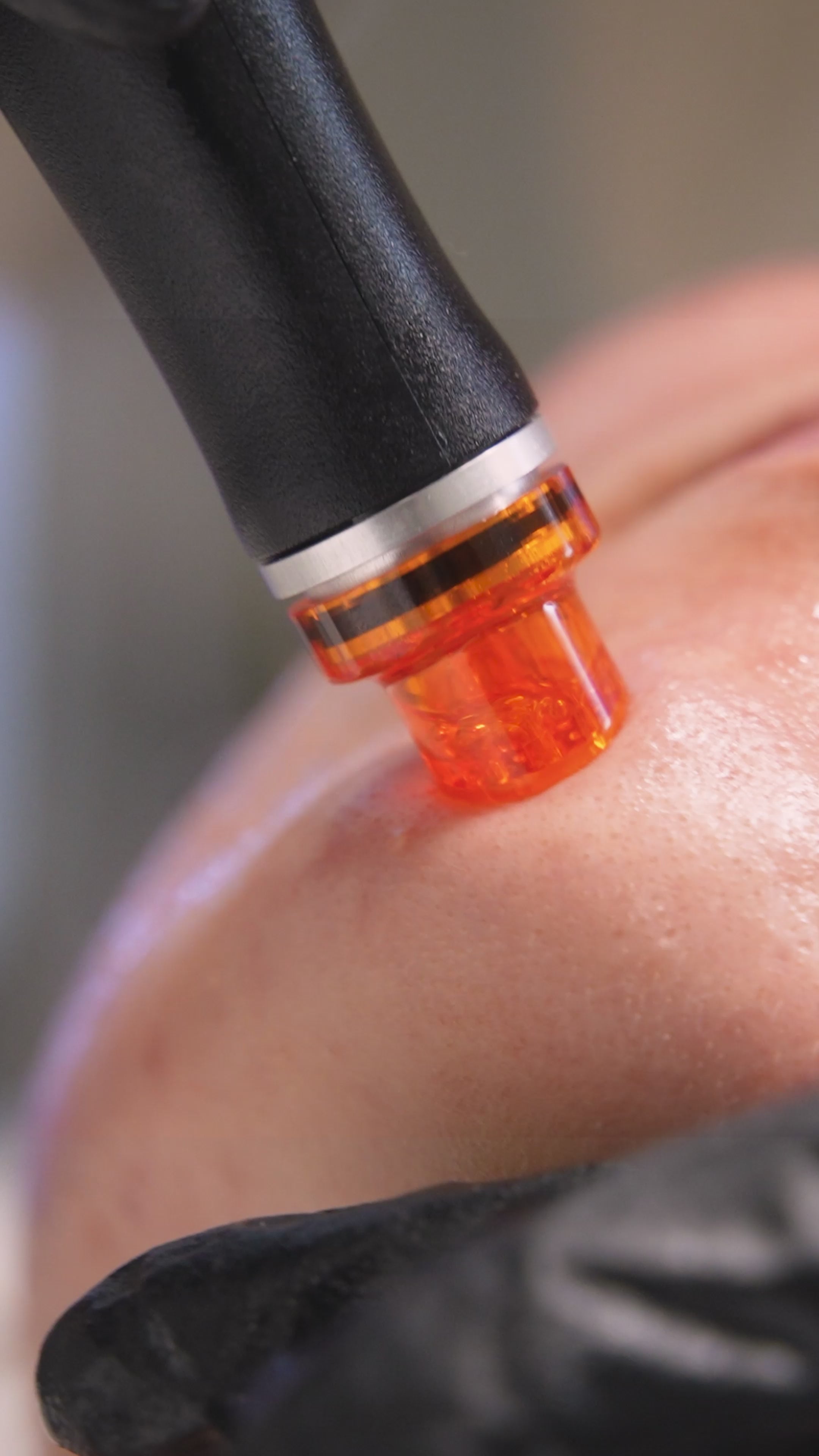 Hydrafacial Behandlungen